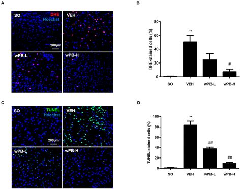 Neuroprotective Effects of Water Extract from Brown Algae Petalonia ...
