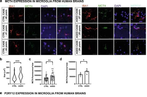 Aging brain cell microglia tied to neurological disorders