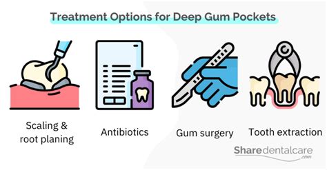 Image result for Gum Paste Pocketing