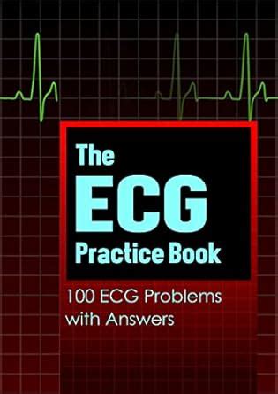 The ECG Practice Book: 100 ECG Problems with Solutions eBook : Books ...