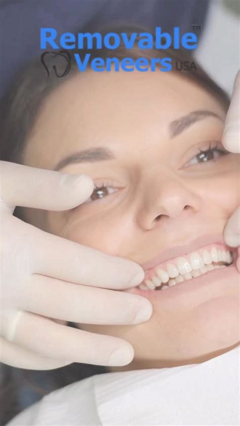 Affordable Dental Crown Alternatives | Removable Veneers USA