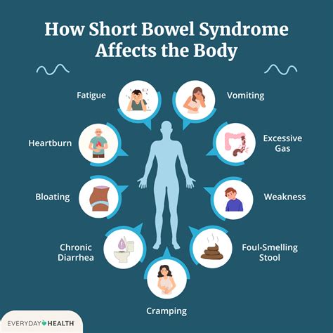 How to Manage Short Bowel Syndrome