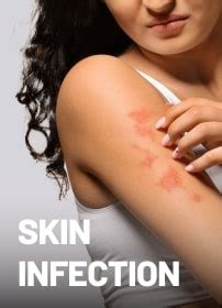 Shop Best Skin Care Products Online - Apollo Pharmacy