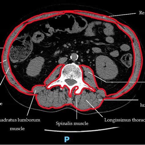 CT Scan Example 的图像结果