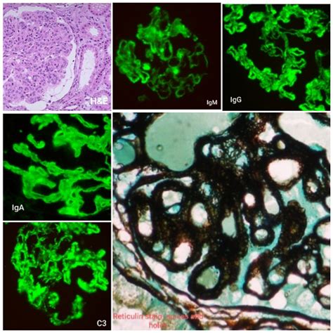 Department of Pathology - Chettinad Academy