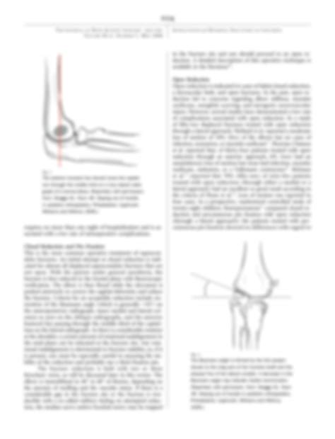 SOLUTION: Supracondylar humeral fractures in children - Studypool