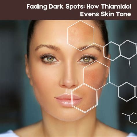 Thiamidol: A Game-Changer for Dark Spots, Hyperpigmentation | Clinikally