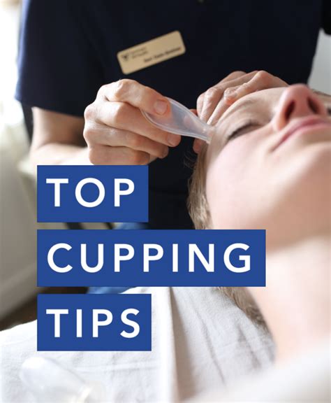 Image result for Cupping Tutorial