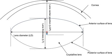Effects of accommodation on geometrical parameters of human lens: A ...
