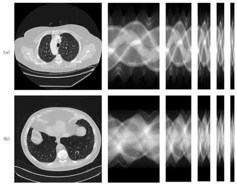 An Efficient Sinogram Domain Fully Convolutional Interpolation Network ...