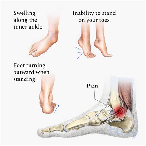 Pain On Inner Ankle And Foot Hotsell | emergencydentistry.com