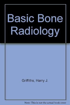 Buy Basic Bone Radiology Book Online at Low Prices in India | Basic ...