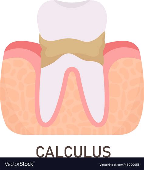 Image result for Tooth Calculus