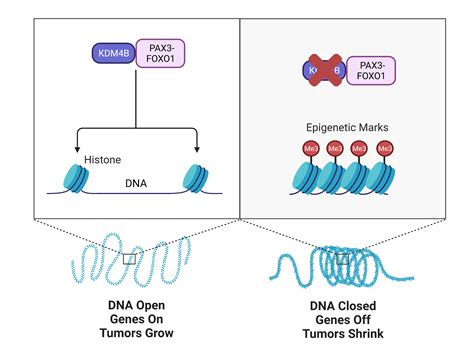 Treating Rhabdomyosarcoma by Blocking KDM4B Enzyme - NCI