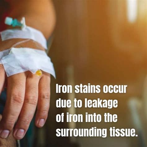 Top 5 Iron Infusion Side Effects & How To Prevent Them - Dr Davin Lim