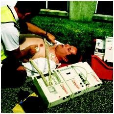 Image result for Defibrillation Procedure