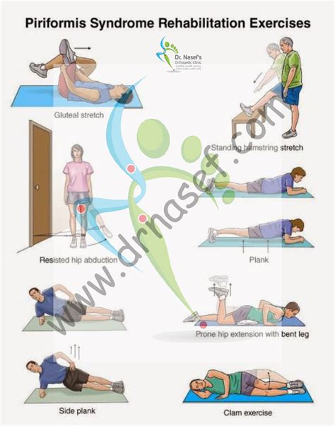 Piriformis Syndrome Rehabilitation Exercises Illustration