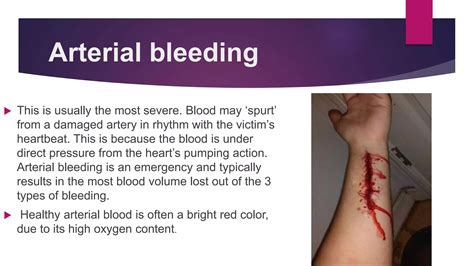 Types of bleeding ppt | PPTX