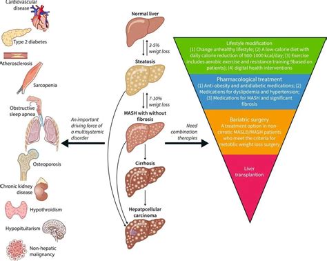 深度解析，MASH常用小鼠模型汇总 - 知乎
