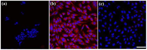 Anti-Neuroblastoma Activity of Gold Nanorods Bound with GD2 Monoclonal ...