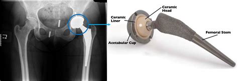 Translational Center on Biomaterials for Orthopedic and Dental applications