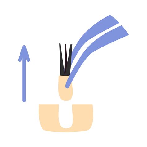 Hair transplant treatment forceps symbol. Surgical tweezers pulling out hair follicle. Alopecia ...