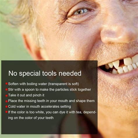 Buy ਦੰਦਾਂ ਦੀ ਅਸਥਾਈ ਮੁਰੰਮਤ, ਤਤਕਾਲ ਵਿਨੀਅਰ ਦੰਦਾਂ, ਪ੍ਰੋਸਟੈਸਟਿਕ ਦੰਦਾਂ ਦੀ ...