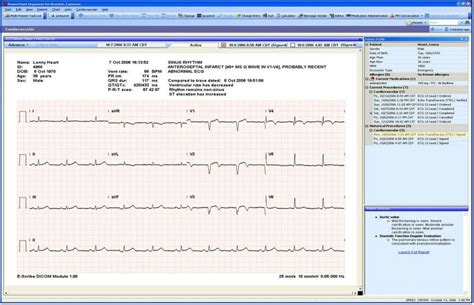 PowerChart 的图像结果