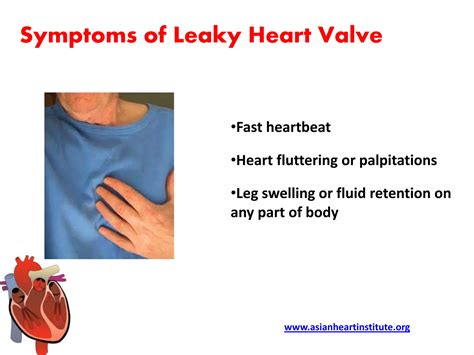 Asian Heart Institute - Leaky heart valve symptoms | PPTX