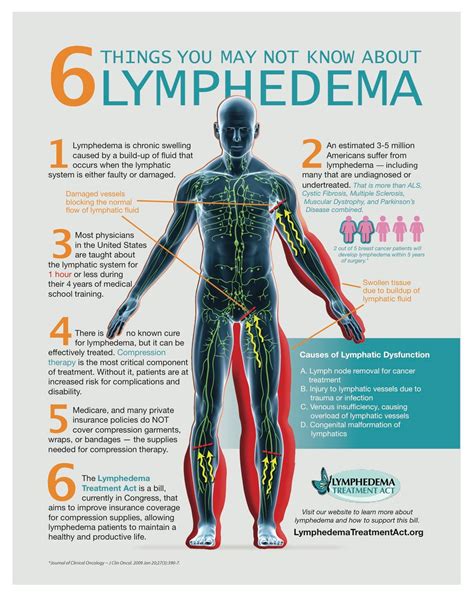 6 Things to Know About Lymphedema | Lymphedema treatment, Lymphedema, Lymphedema awareness