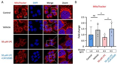Lysophosphatidylcholine Impairs the Mitochondria Homeostasis Leading to ...