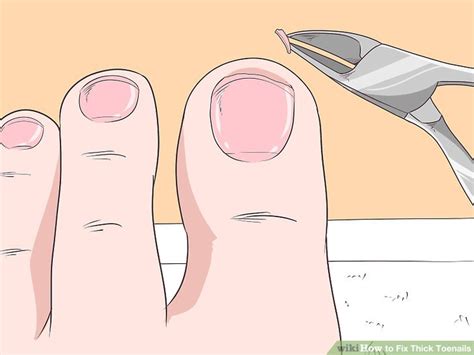 Image result for How File Thick Toenails