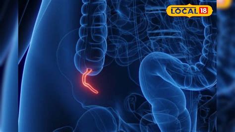 Recurring Stomach Pain Could it be a Sign of Appendicitis Learn ...