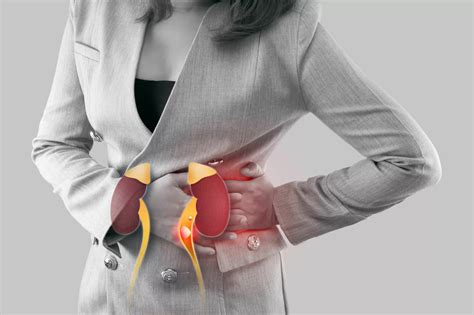 Nephrolithiasis: Causes, Symptoms & Treatment