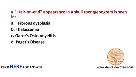 Dentosphere : World of Dentistry: Hair-on-end appearance in a skull ...