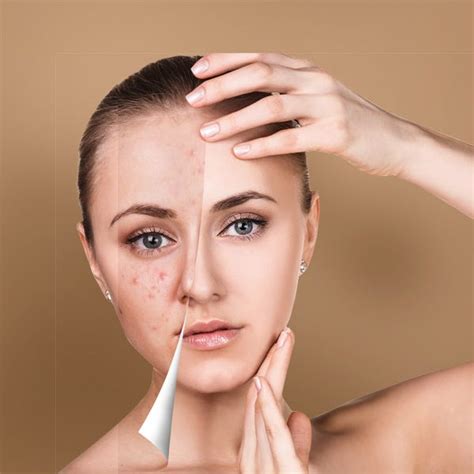 Services Landing Page