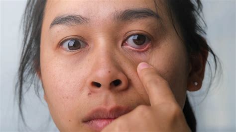 Disease can be detected by looking at the face, the doctor told how to ...