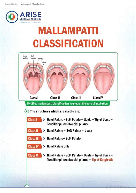 Anaesthesia Flashcards: Key Concepts and Classifications - Studocu