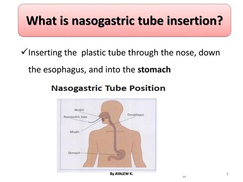 NASOGASTRIC TUBE INSERTION.pdf