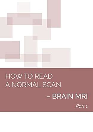 HOW TO READ A NORMAL SCAN: BRAIN MRI PART 1 (NEURORADIOLOGY: How to ...