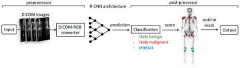 AI-Based Noise-Reduction Filter for Whole-Body Planar Bone Scintigraphy ...