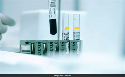 'Golden Blood': All About The Rarest Blood Type Found In Less Than 50 ...