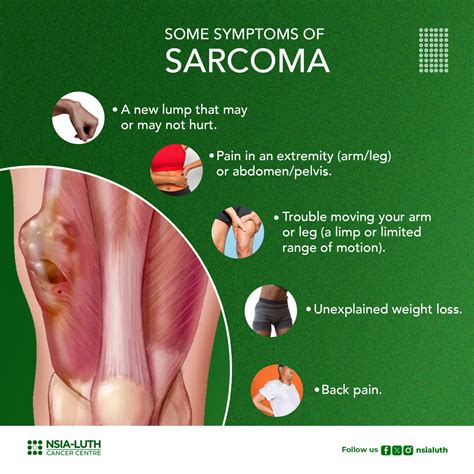 Liposarcoma Symptoms Soft Tissue Sarcomas For Patients