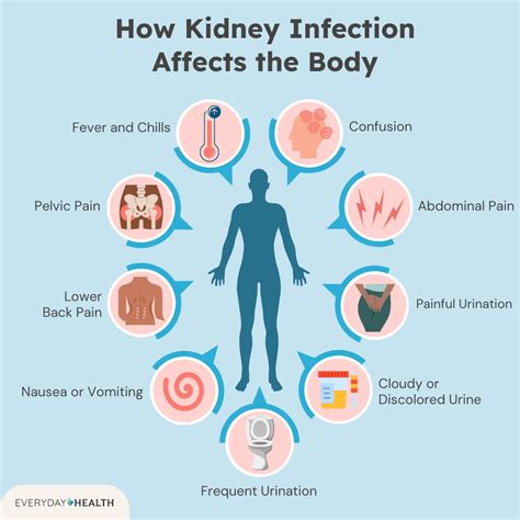 What Is a Kidney Infection? Symptoms, Causes, Diagnosis, Treatment, and Prevention