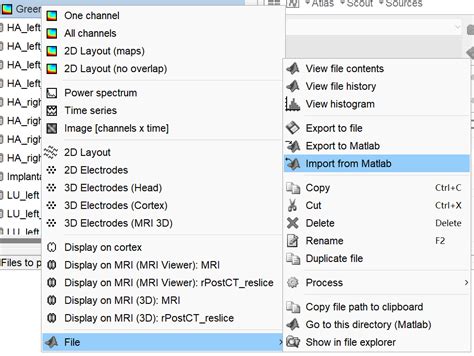 EEG MATLAB Load File 的图像结果