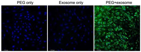 Optimization Protocol of the PEG-Based Method for OSCC-Derived Exosome ...