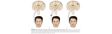 Buy Lange Clinical Neurology and Neuroanatomy: A Localization-Based ...