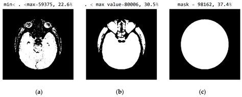 Smart Visualization of Medical Images as a Tool in the Function of ...