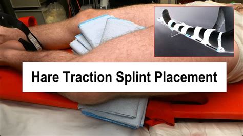 Hare Traction Splint Application 的图像结果