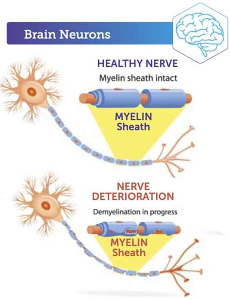 Astaxanthin Benefits for Brain Health and Cognitive Support - Life ...
